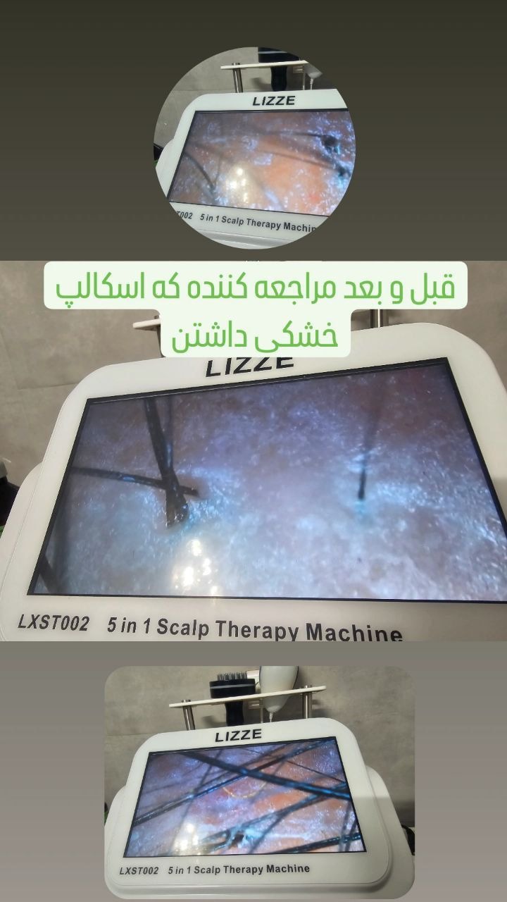 دو روش آموزش اسکالپ سر